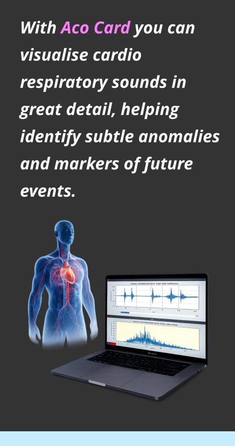 With Aco Card you can visualise cardio respiratory sounds in great detail, helping identify subtle anomalies and markers of future events.